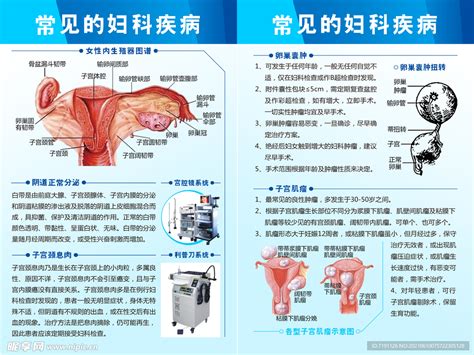 婦科病|妇科疾病（病症名称）